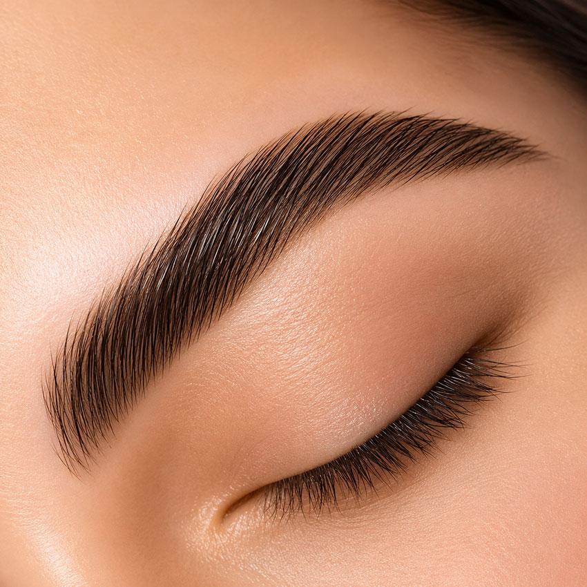 Brow Lift